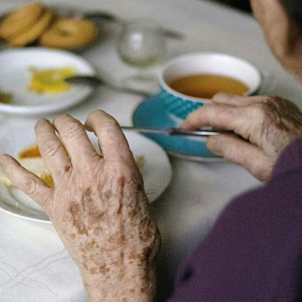 Ältere Patientin mit Fingerarthrose und schmerzenden Fingergelenken im Alltag